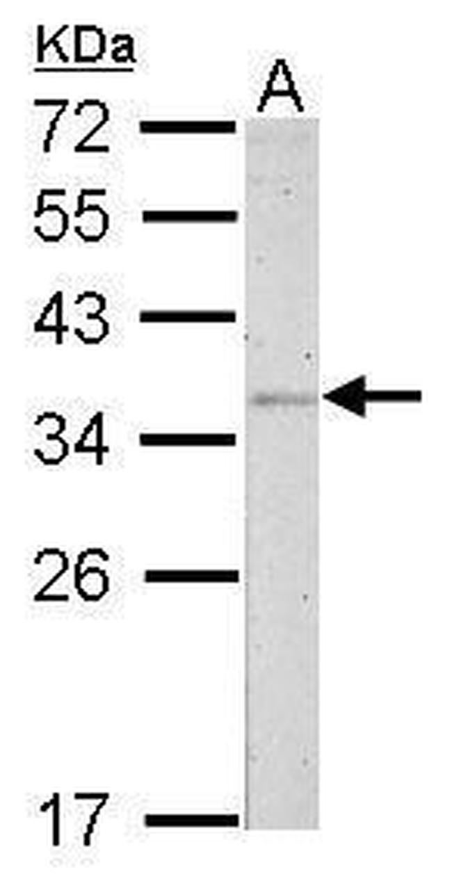 Fibrillarin Antibody in Western Blot (WB)