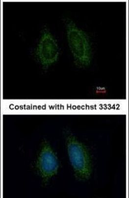 ERp57 Antibody in Immunocytochemistry (ICC/IF)