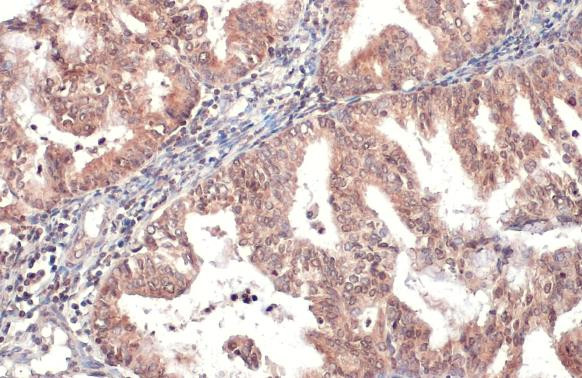 HYAL1 Antibody in Immunohistochemistry (Paraffin) (IHC (P))