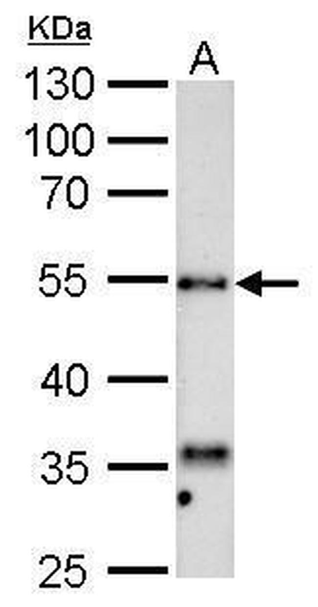 HYAL1 Antibody in Western Blot (WB)