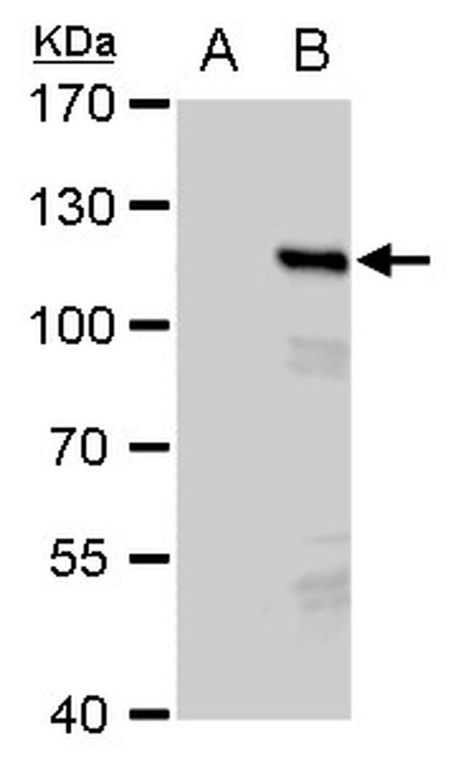 PMS2 Antibody in Western Blot (WB)