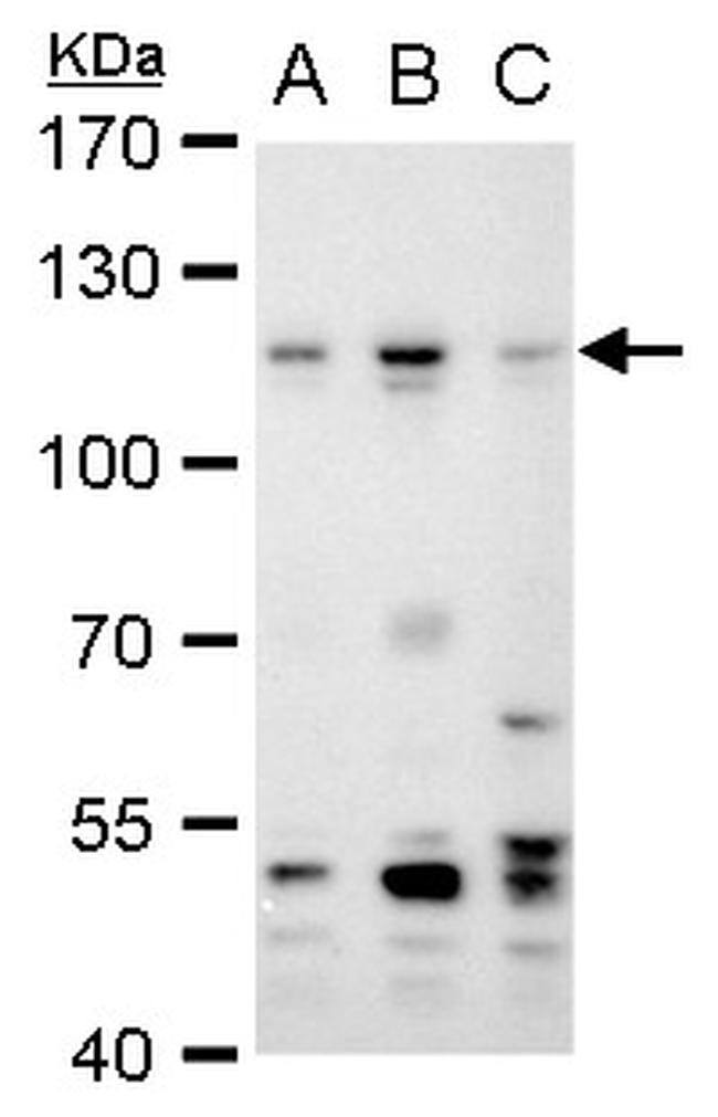 PMS2 Antibody in Western Blot (WB)