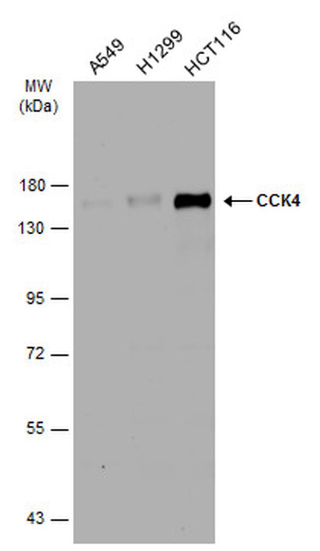 PTK7 Antibody in Western Blot (WB)