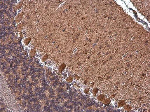 RAP1GAP Antibody in Immunohistochemistry (Paraffin) (IHC (P))