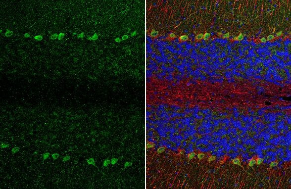 TRPC6 Antibody in Immunohistochemistry (Paraffin) (IHC (P))