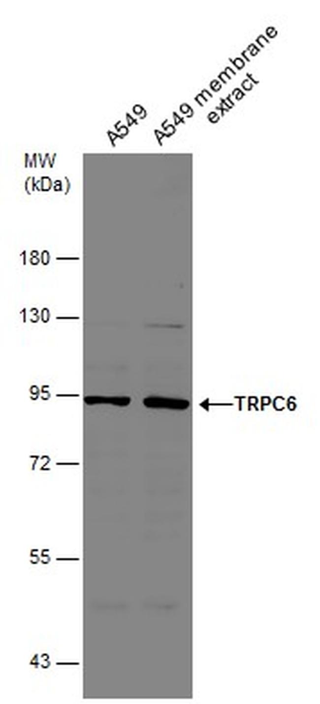 TRPC6 Antibody in Western Blot (WB)