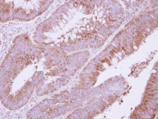 ADAMTS1 Antibody in Immunohistochemistry (Paraffin) (IHC (P))