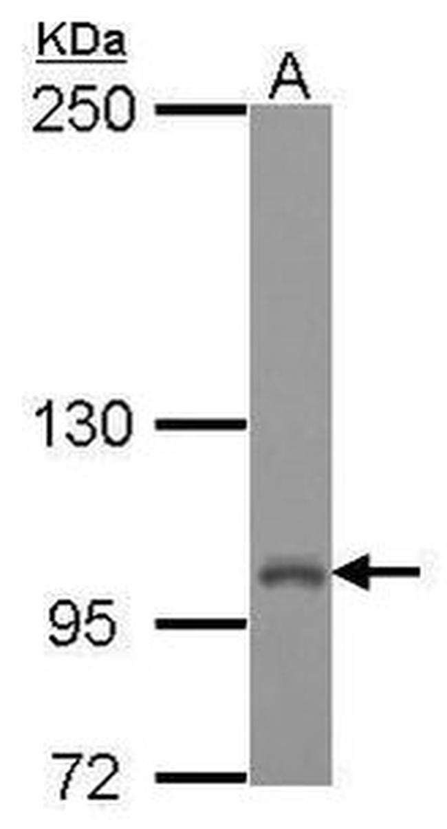 ADAMTS1 Antibody in Western Blot (WB)