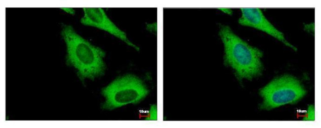 IGF2BP2 Antibody in Immunocytochemistry (ICC/IF)