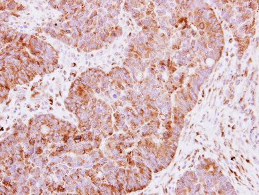 IGF2BP2 Antibody in Immunohistochemistry (Paraffin) (IHC (P))