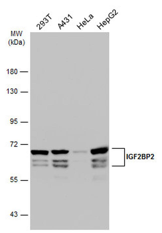 IGF2BP2 Antibody in Western Blot (WB)