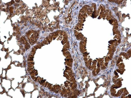 CHP1 Antibody in Immunohistochemistry (Paraffin) (IHC (P))