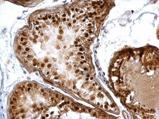 DUSP16 Antibody in Immunohistochemistry (Paraffin) (IHC (P))