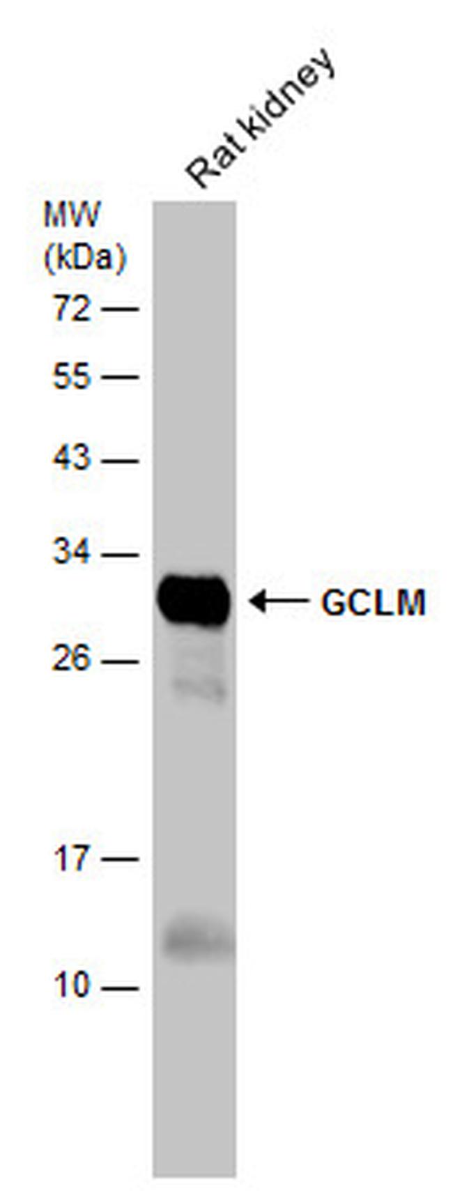 GCLM Antibody in Western Blot (WB)