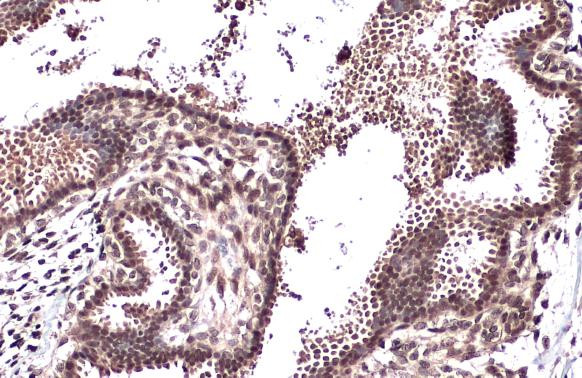 CRM1 Antibody in Immunohistochemistry (Paraffin) (IHC (P))