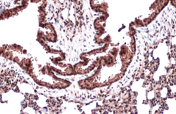 CRM1 Antibody in Immunohistochemistry (Paraffin) (IHC (P))