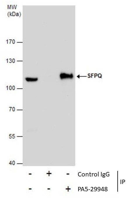 SFPQ Antibody in Immunoprecipitation (IP)