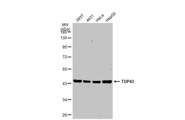 TDP-43 Antibody in Western Blot (WB)