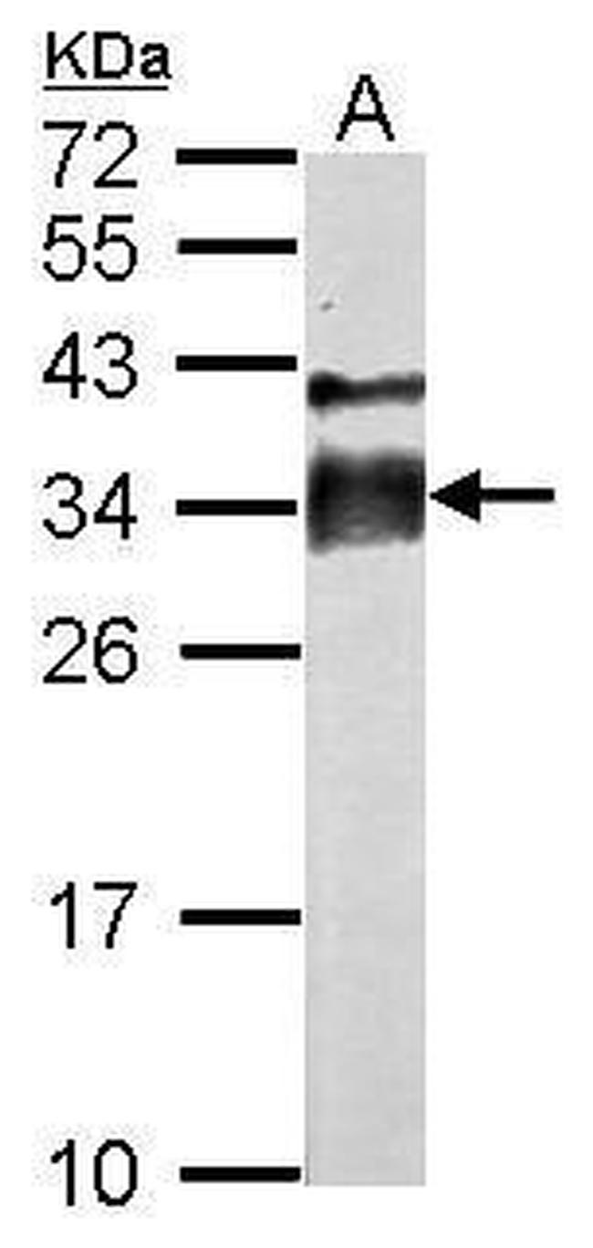 Acrosomal Vesicle Protein Antibody in Western Blot (WB)