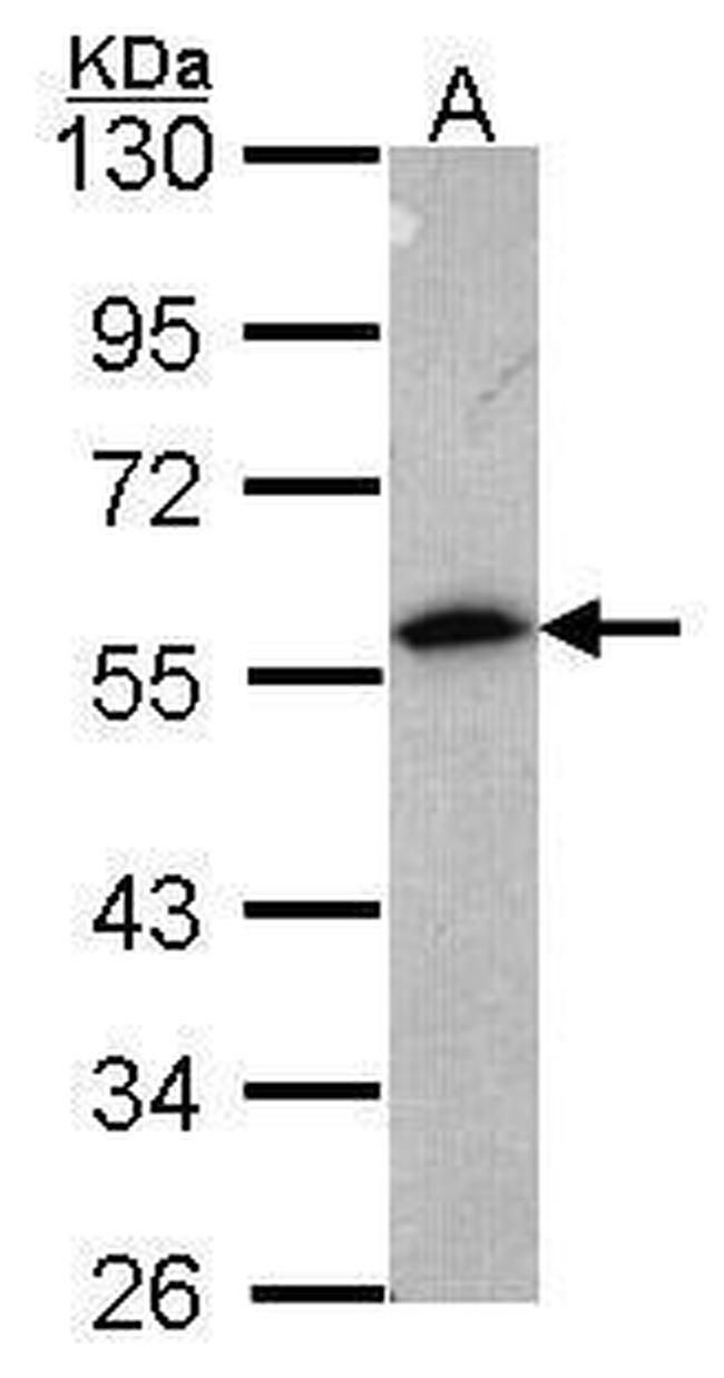 Annexin A11 Antibody in Western Blot (WB)