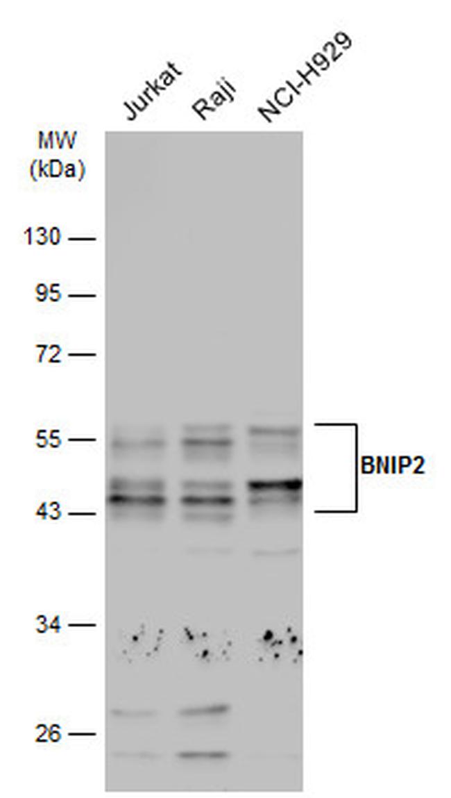 BNIP2 Antibody in Western Blot (WB)