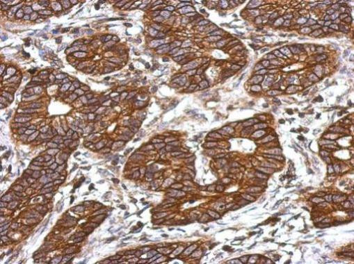 C3a Receptor Antibody in Immunohistochemistry (Paraffin) (IHC (P))