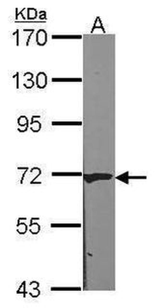 CAT1 Antibody in Western Blot (WB)