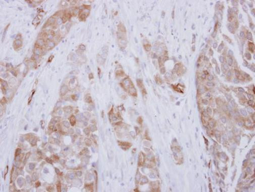 DPH2 Antibody in Immunohistochemistry (Paraffin) (IHC (P))