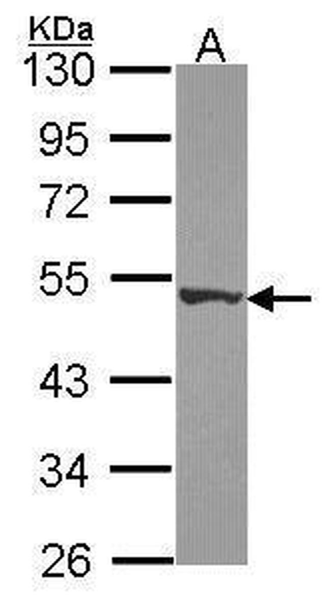 DPH2 Antibody in Western Blot (WB)