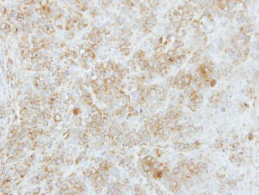 FMO5 Antibody in Immunohistochemistry (Paraffin) (IHC (P))