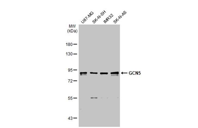 GCN5 Antibody in Western Blot (WB)