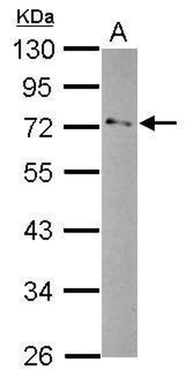 GPD2 Antibody in Western Blot (WB)