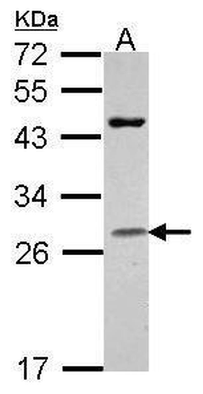 Granzyme H Polyclonal Antibody (PA5-30053)