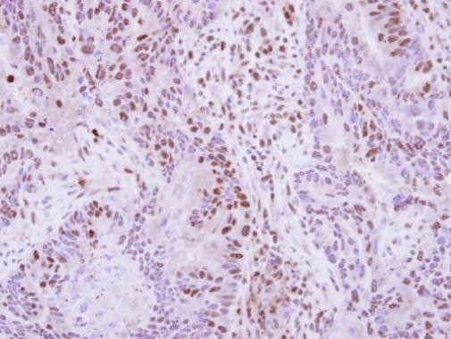 hnRNP A2B1 Antibody in Immunohistochemistry (Paraffin) (IHC (P))