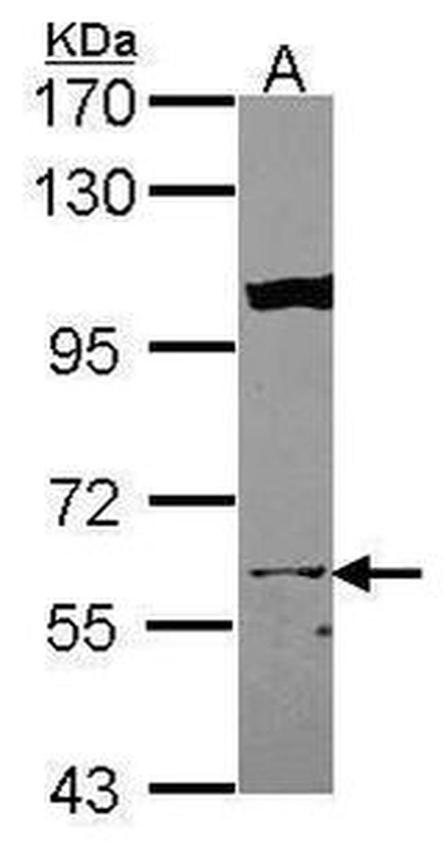 KPNA3 Antibody in Western Blot (WB)