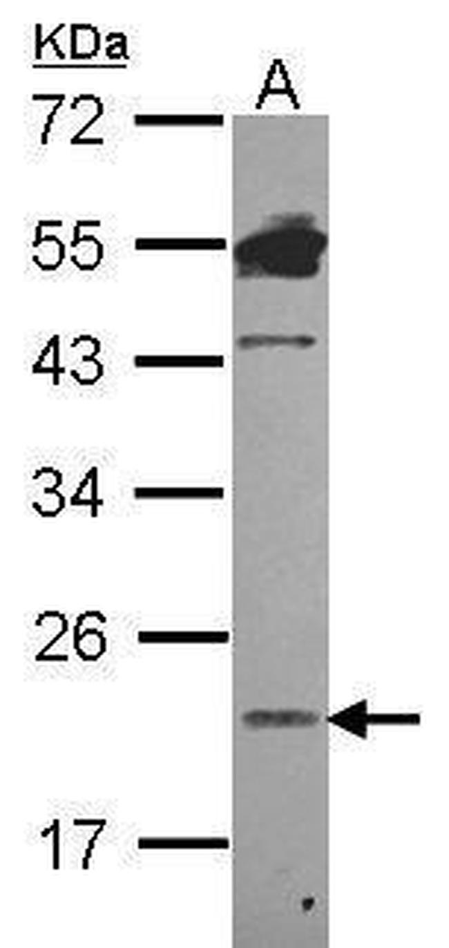 LCN1 Antibody in Western Blot (WB)