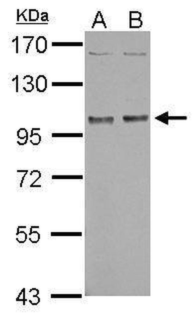 NBR1 Antibody in Western Blot (WB)