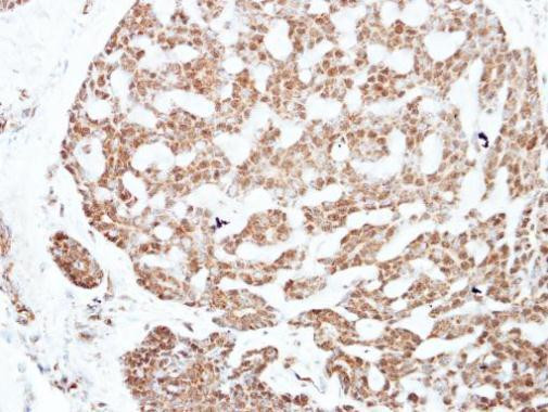 NFIC Antibody in Immunohistochemistry (Paraffin) (IHC (P))