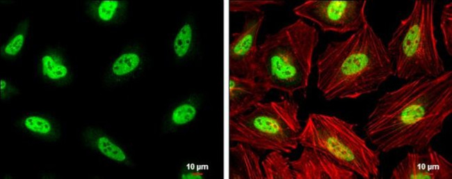 PCBP2 Antibody in Immunocytochemistry (ICC/IF)