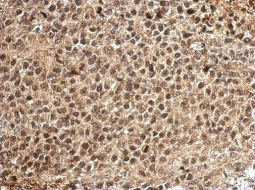 PCBP2 Antibody in Immunohistochemistry (Paraffin) (IHC (P))