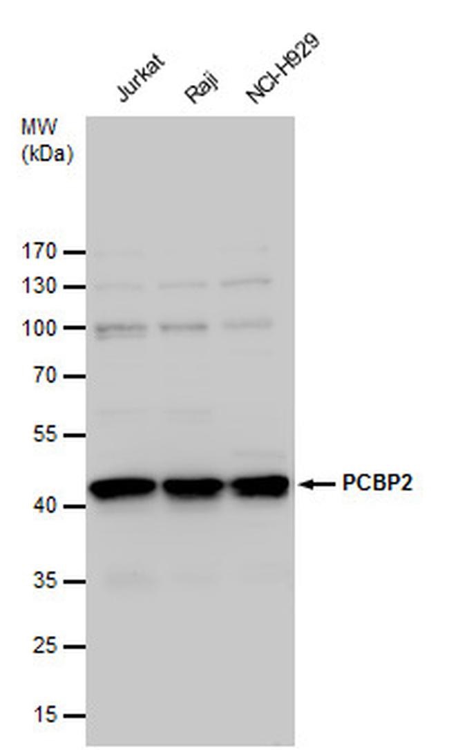 PCBP2 Antibody in Western Blot (WB)