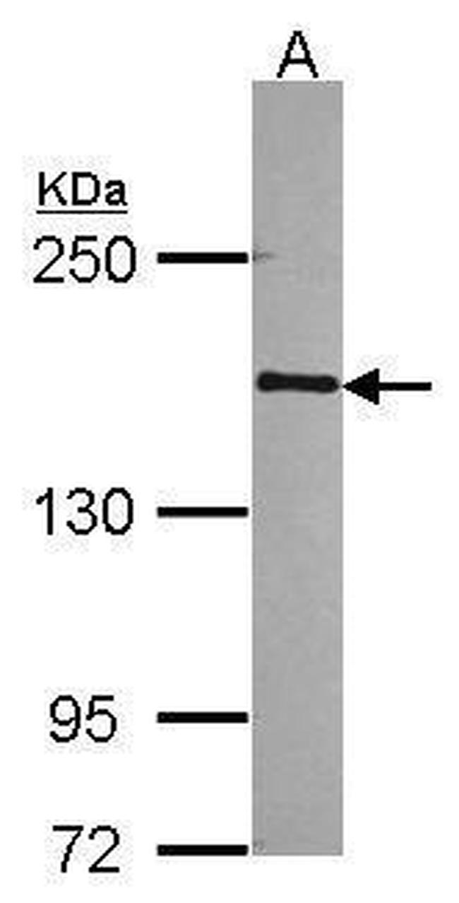 POLR2B Antibody in Western Blot (WB)