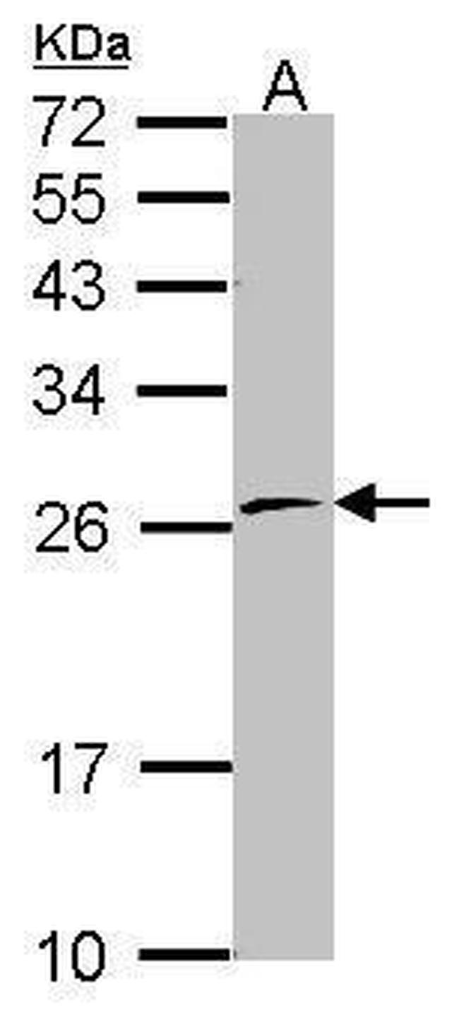 POLR2E Antibody in Western Blot (WB)