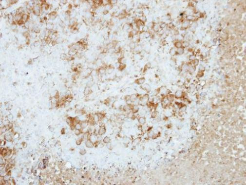 RAP2B Antibody in Immunohistochemistry (Paraffin) (IHC (P))