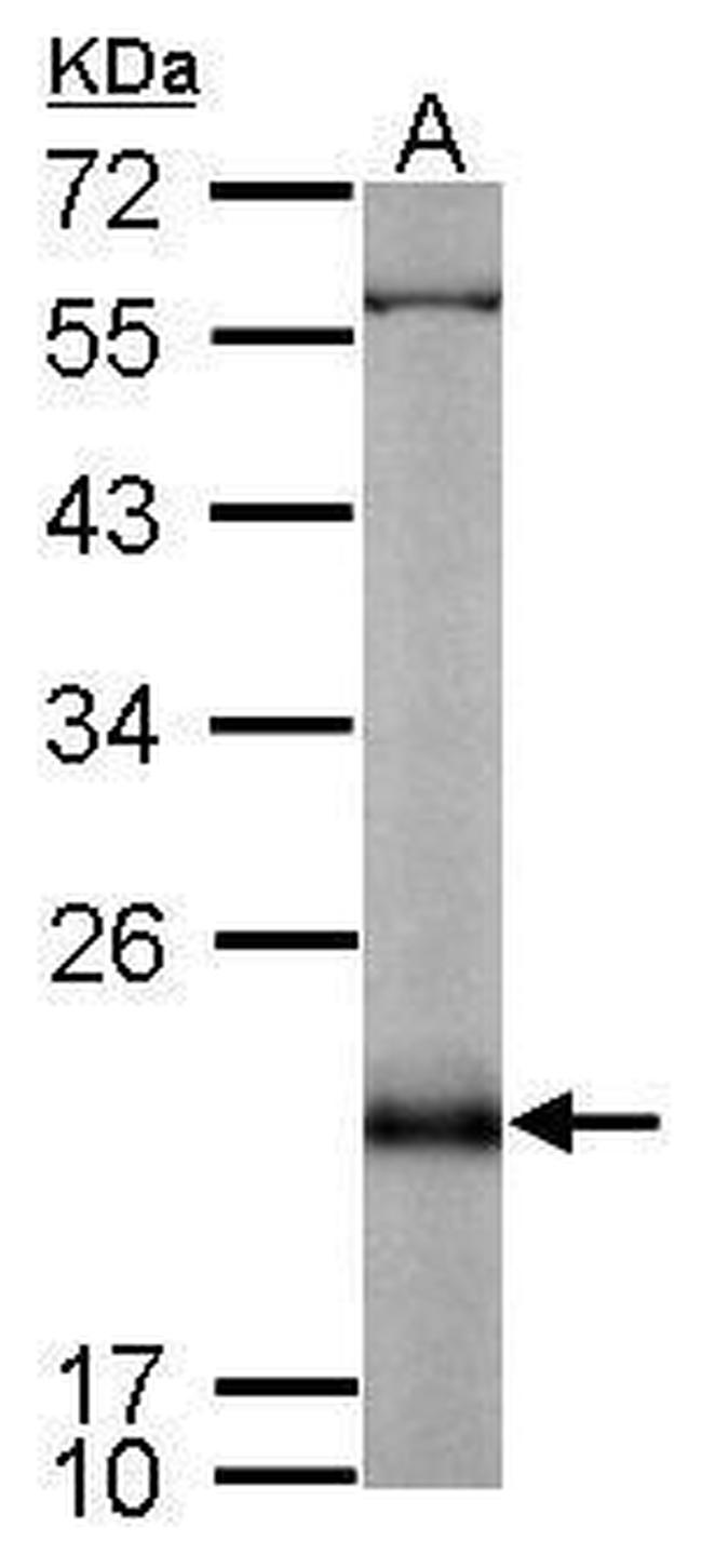 RAP2B Antibody in Western Blot (WB)