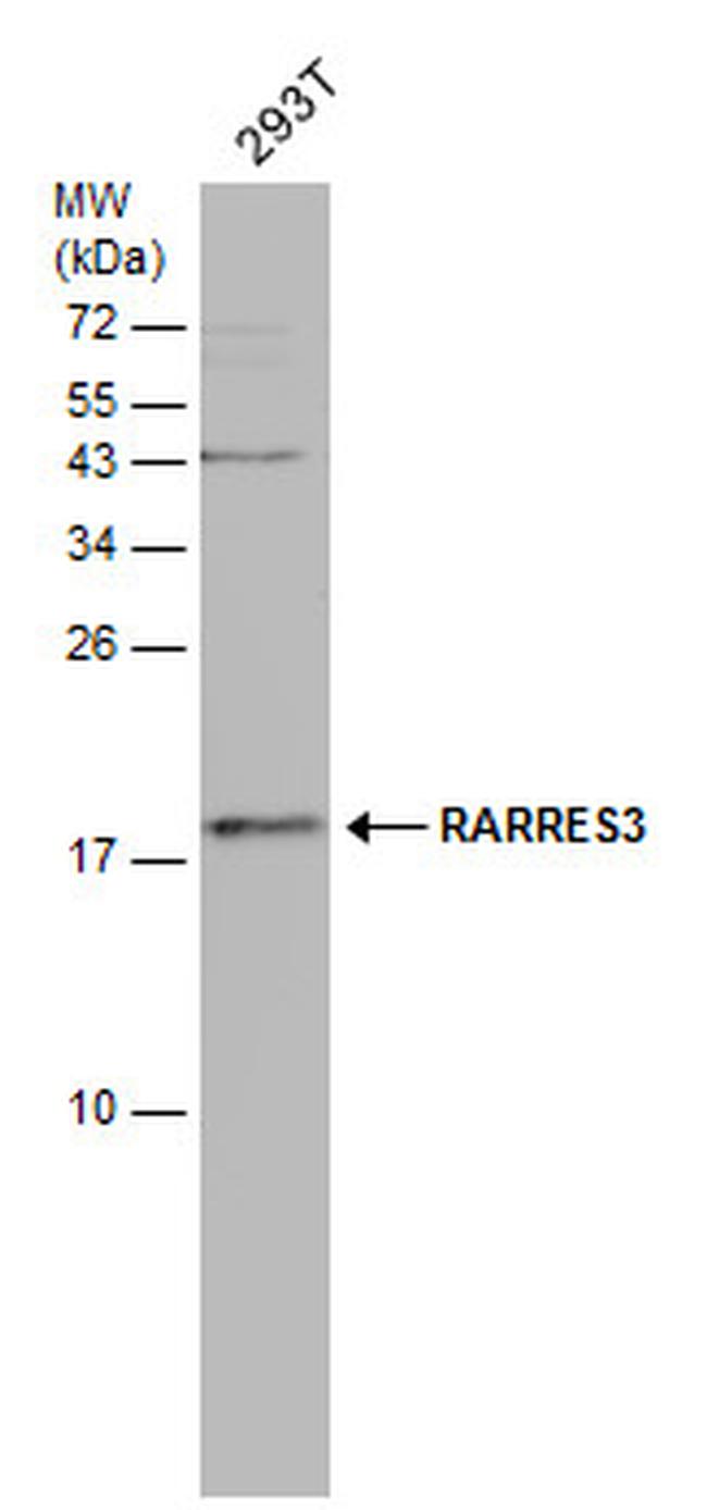 RARRES3 Antibody in Western Blot (WB)