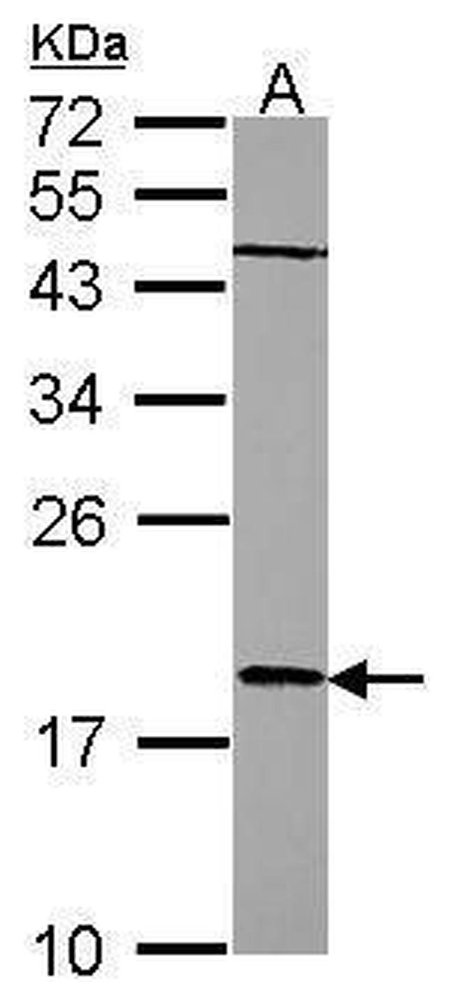 RARRES3 Antibody in Western Blot (WB)