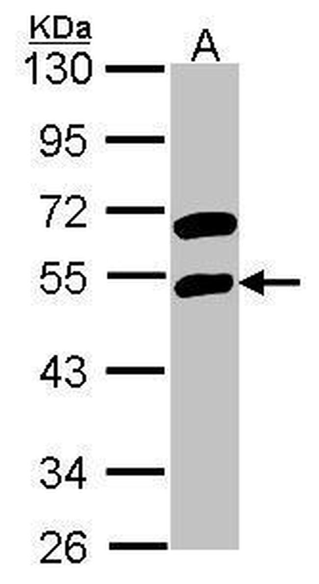 RBMS1 Antibody in Western Blot (WB)