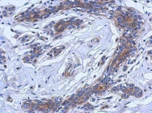 ASM Antibody in Immunohistochemistry (Paraffin) (IHC (P))