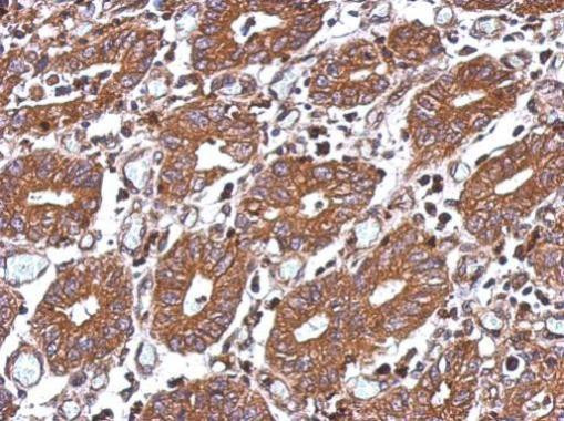 HAI-1 Antibody in Immunohistochemistry (Paraffin) (IHC (P))